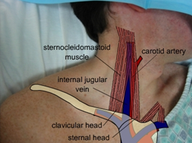 ISAKanyakumari - Anaesthesia Practice in Kanyakumari District