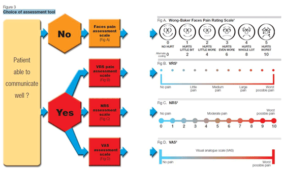 Choice of Assessment Tool