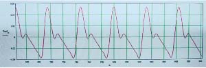 dicrotic notch